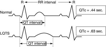 lqtsgraph.jpg
